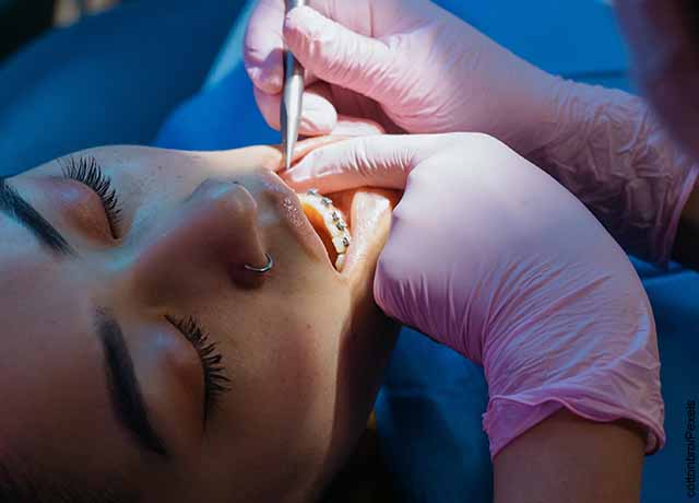 Foto de una mujer en ortodoncia que revela cómo es soñar con agujas